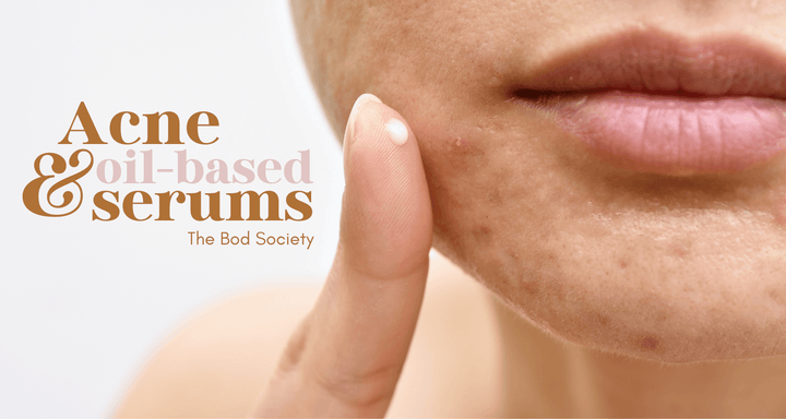 Acne and Oil-based Serums